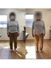 ランドル(rendre)/60代女性　内側のくるぶしの痛み