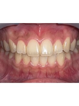 1回ごとにお支払い可能なサロン