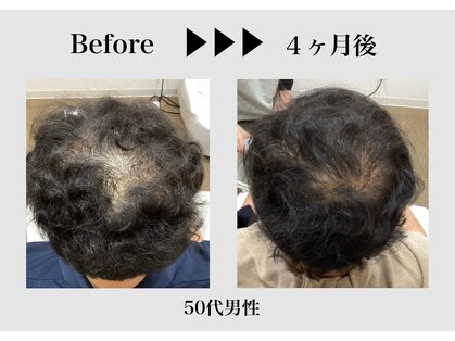 エルプラス(L+)の写真