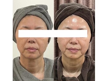 リライズ 磐田(Rerise)/オーダー小顔恵エステ