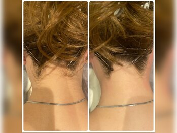 デトックススパボディーラボ/学割U24！全身脱毛がお得です☆