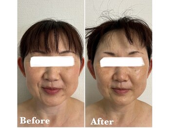 ヴィアージュ(Viage)/レモンボトル