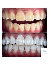 ホワイトニングショップ 奈良生駒店/自慢の歯を目指しましょう！