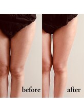 スリラ(SuriLa)/◆ビフォーアフター◆