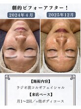 シーフェイス 横浜店(SEE FACE)/定期的な肌ケアでココまで変化！