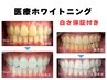 【2回目以降・歯科提携ホワイトニング】通常12,000円→2回目以降9,000円～