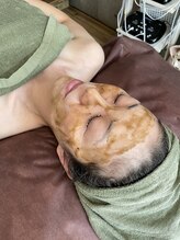 ココベラ(Cocovela)/肌質改善◎ハーブピーリング