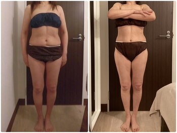 グレイスボディ BiViつくば店(Grace Body)/◆痩身　症例写真