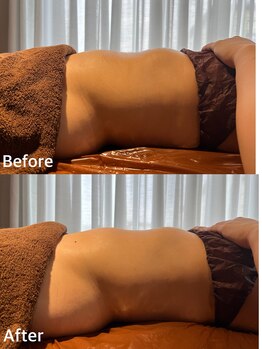 ステラ(Stella)/ぽっこりお腹撃退