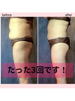 カナウ(kanau)/たった3回で!