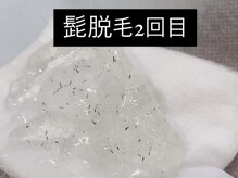 だんごバレエ団202/その場で抜けるポップアップ現象