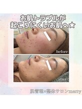 メリー 大和西大寺店(merry)/お悩み別にカスタムできる♪