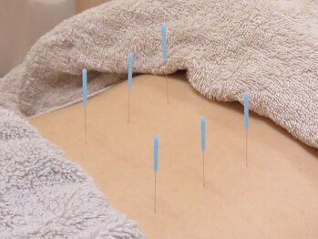 いろは鍼灸院の写真/【仕事の疲れを感じている方へ】慢性的なお悩みを根本から改善☆鍼施術+ボディケアで日々の疲れを緩和！