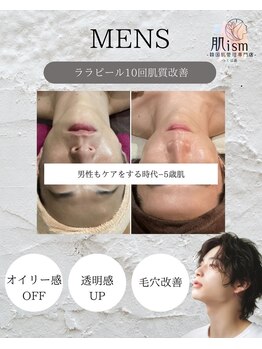 肌イズム つくば店(肌ism)/男性ララピール10回の結果