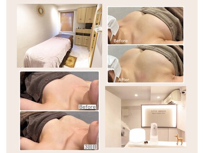 リリーパッソ(Lily passo)の写真