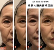 札幌大通美容矯正サロン