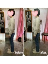 ララスマイル 鶴崎森町店/反り腰が改善し頭が軽い！