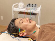 はり結の雰囲気(美顔鍼 男性)