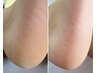 【新規】フットケア（ジェルオフなし）¥8300