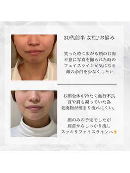 メディカルエステ 東銀座店/30代前半 女性