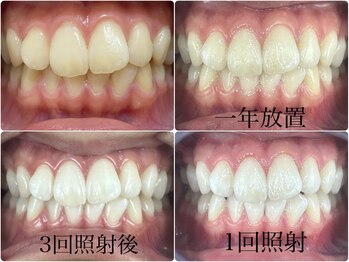 グラスプレイス/プレミアム症例 8