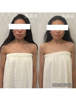 エイミー(Amy)/アラフォー世代のお客様の変化