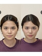 小顔22 ボルティ 本店(Bolty)/小顔シンメトリー矯正＆全身矯正