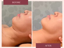 トリプルサンショップ 京都店/【極上フェイシャルスペシャル】