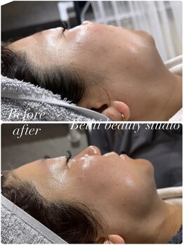 ベルティ(Bellti)/一度で効果実感