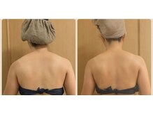 シピリカ(sipirka)の雰囲気（パワーレメディ2回施術で肩のラインスッキリ！）