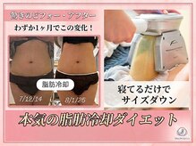 ルアナ(Luana)の雰囲気（1回で-2cm減！サイズダウン！まつげ、フェイシャル同時施術◎）