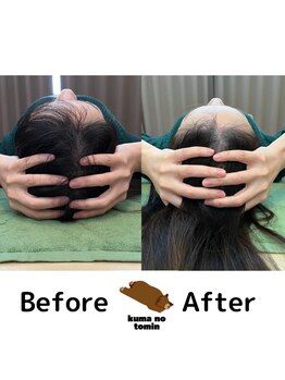 クマの冬眠 高知店/食い縛りエラハリ身体のケア