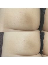 スウィートマジョラム(Sweet Marjoram)/Eライトボディ