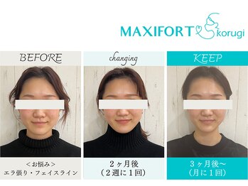 コルギ専門店 マキシフォート 栄店(Maxifort)/お客さまからの感想