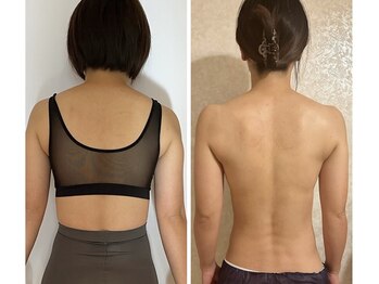 ザ エステティック福岡/ピラティス×ウルトラで美ボディ