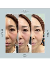 ラプティット(La petite)/50代女性/3回の変化