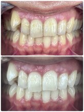 グラスプレイス/プレミアム症例　9