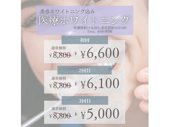 リマゴミニ(Remago mini)