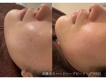 アイル 船橋店(iru)/