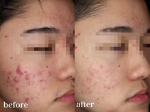 リアルナ(REALUNA)/