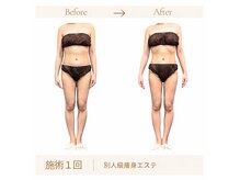 サロンドリミー 高松 国分寺(Salon de Re:me)の雰囲気(不調改善×姿勢矯正×美ボディ形成を同時に叶えます)