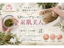 デンドロビューム(Dendrobium)