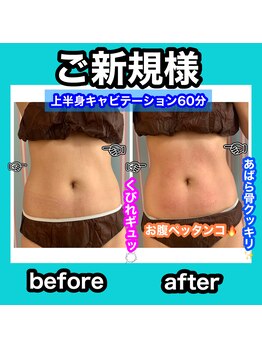 ビューティ ウィッチ(Beauty Witch)/お腹のお肉サヨナラ！