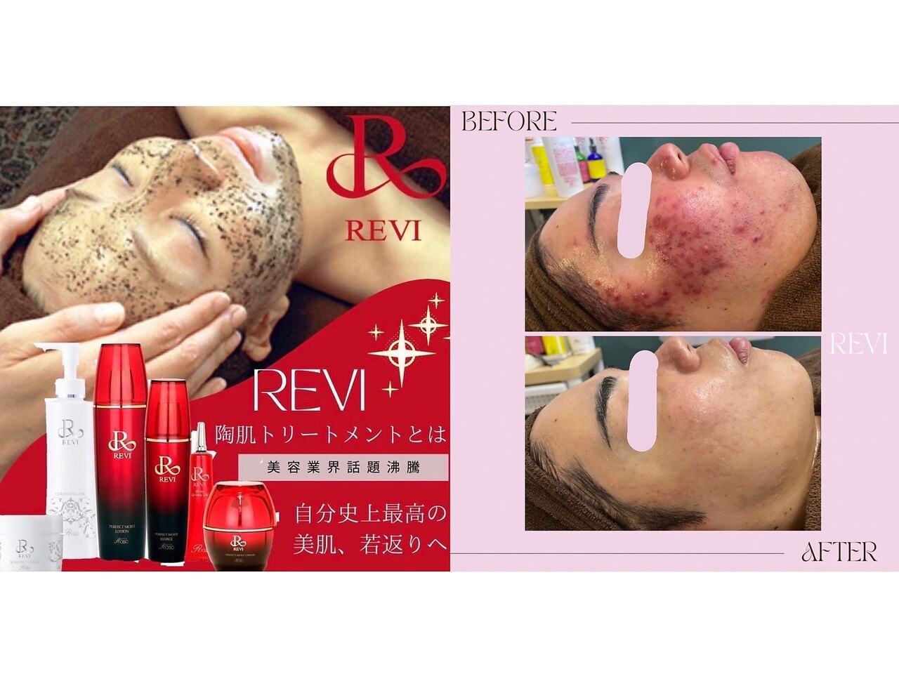 沖縄県でエレクトロポレーションが人気のエステサロン