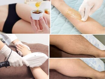 ジーワックス(G WAX)の写真/【丁寧なWAX脱毛VIO1回女性¥3980・男性¥8000/W脱毛女性¥7980・男性¥12000/おしゃれうなじWAX＋光W¥5500】
