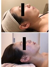 エイシスグロウ(asis glow.)/効果写真