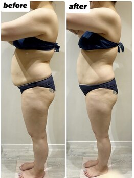 ビンナ 五反田店(Binna)/お任せ180分