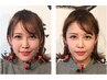 【人気No１★水光LIFT小顔矯正・マシン以上の効果】アルティマリフト