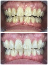 グラスプレイス/プレミアム症例　10