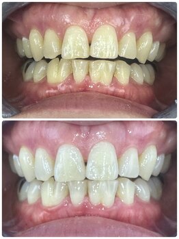 グラスプレイス/プレミアム症例 10